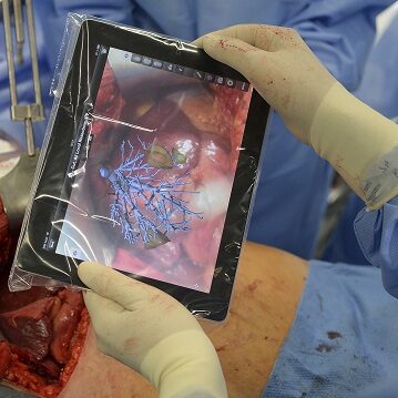 Fraunhofer MEVIS – iPad i rzeczywistość rozszerzona podczas operacji