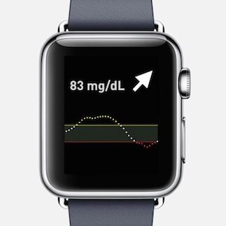 Apple Watch ekranem dla glukometrów od Dexcom
