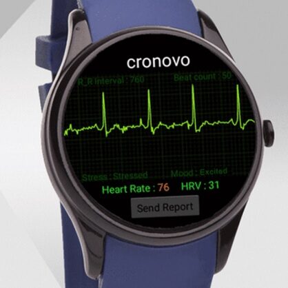 Cronovo EKG Smartwatch – tracker zdrowia