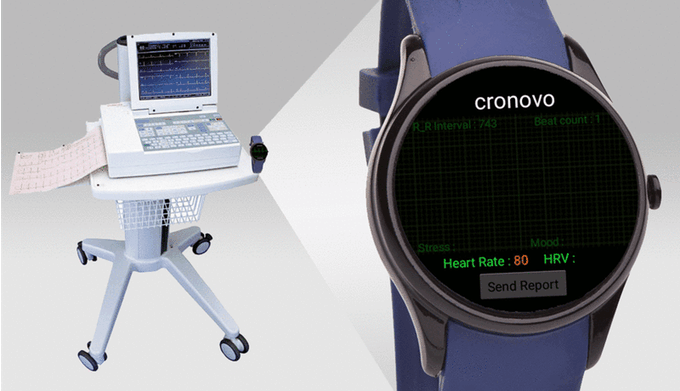 Cronovo EKG Smartwatch