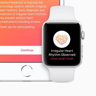 Apple Heart Study – badaj serce przez Apple Watch